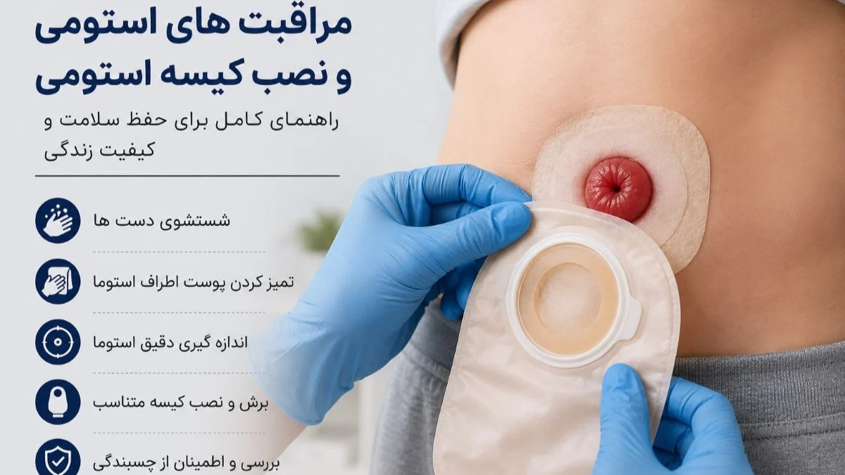 مراقبت های استومی